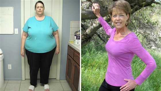 женщина до и после похудения